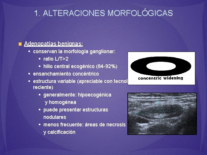 1. ALTERACIONES MORFOLÓGICAS Adenopatías benignas: § conservan la morfología ganglionar: § ratio L/T>2 §