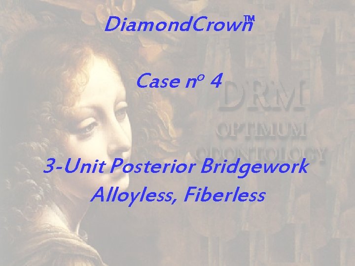 Diamond. Crown TM o Case n 4 3 -Unit Posterior Bridgework Alloyless, Fiberless 