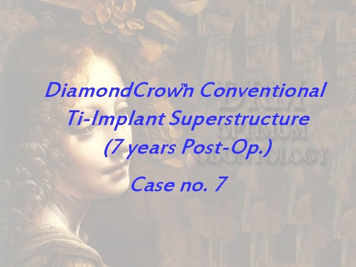 Diamond. Crown Conventional Ti-Implant Superstructure (7 years Post-Op. ) Case no. 7 TM 