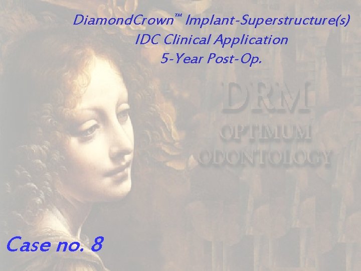 Diamond. Crown™ Implant-Superstructure(s) IDC Clinical Application 5 -Year Post-Op. Case no. 8 