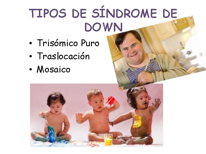 TIPOS DE SÍNDROME DE DOWN • Trisómico Puro • Traslocación • Mosaico 