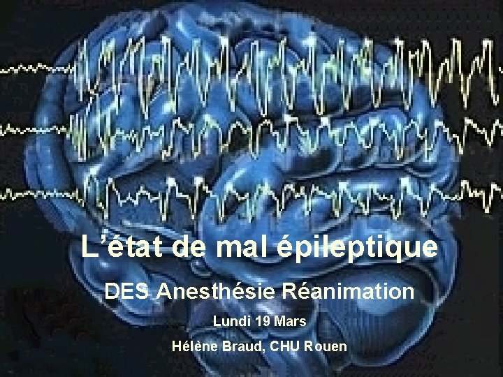 L’état de mal épileptique DES Anesthésie Réanimation Lundi 19 Mars Hélène Braud, CHU Rouen