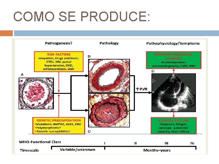 COMO SE PRODUCE: 