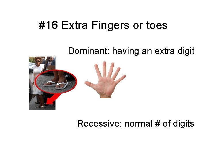 #16 Extra Fingers or toes Dominant: having an extra digit Recessive: normal # of