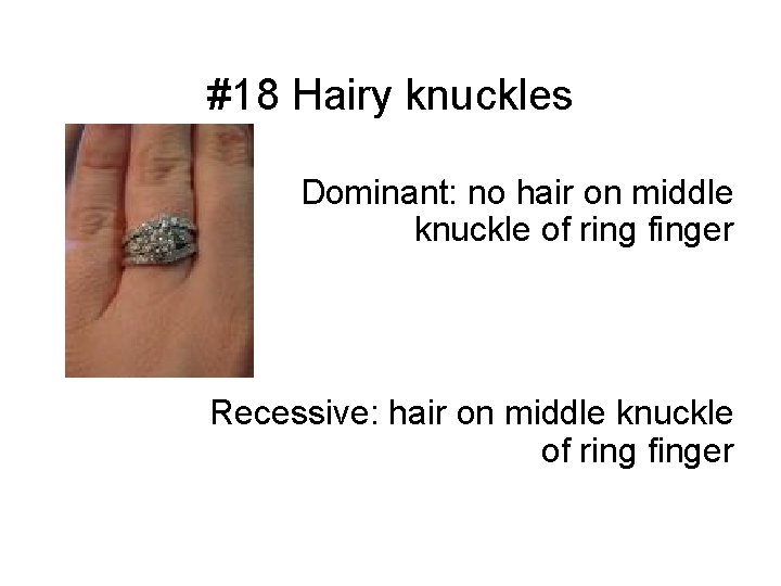 #18 Hairy knuckles Dominant: no hair on middle knuckle of ring finger Recessive: hair