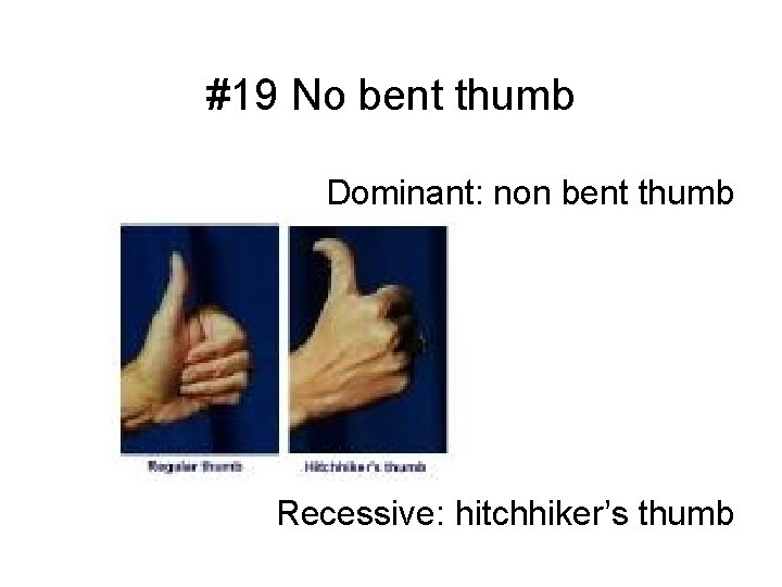 #19 No bent thumb Dominant: non bent thumb Recessive: hitchhiker’s thumb 