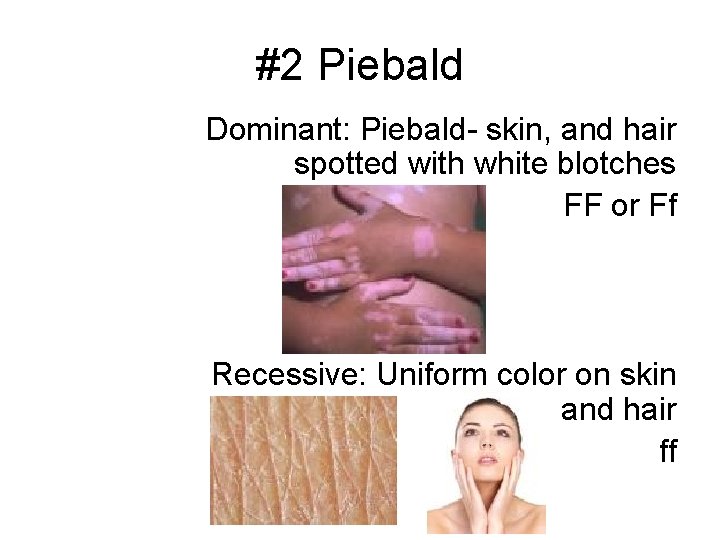 #2 Piebald Dominant: Piebald- skin, and hair spotted with white blotches FF or Ff