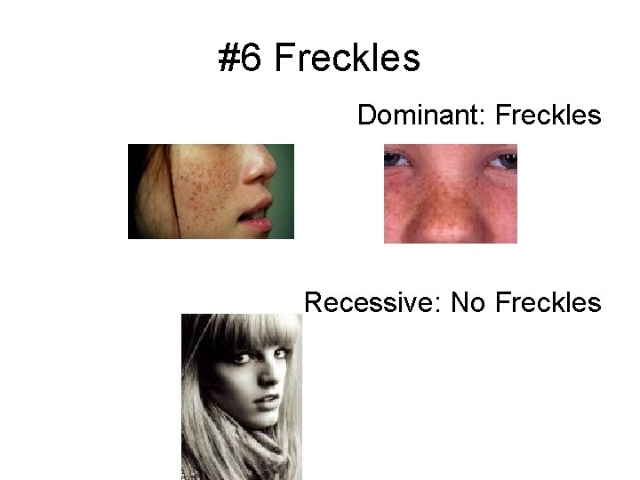 #6 Freckles Dominant: Freckles Recessive: No Freckles 