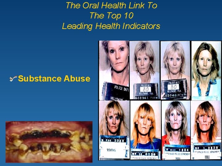 The Oral Health Link To The Top 10 Leading Health Indicators Substance Abuse 