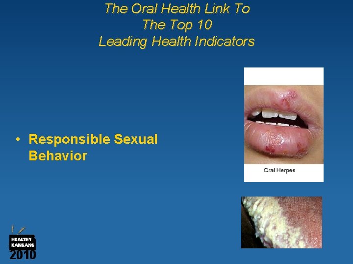 The Oral Health Link To The Top 10 Leading Health Indicators • Responsible Sexual