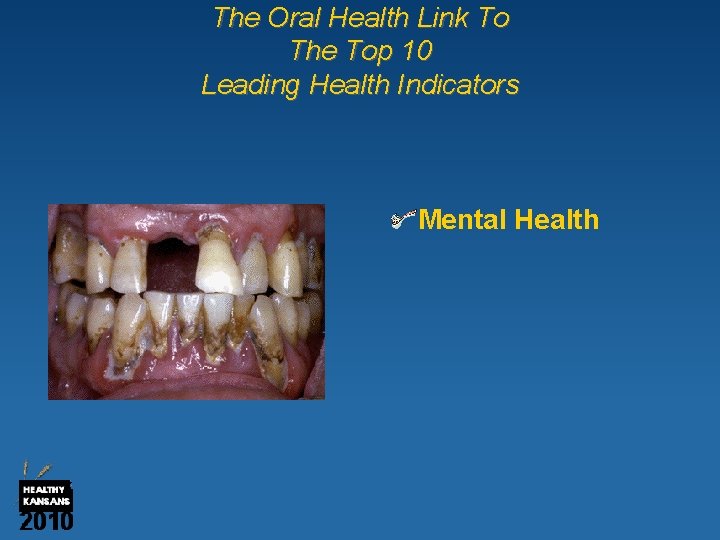 The Oral Health Link To The Top 10 Leading Health Indicators Mental Health 