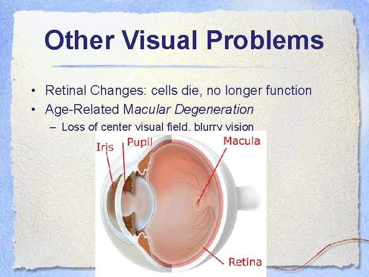 Other Visual Problems • Retinal Changes: cells die, no longer function • Age-Related Macular