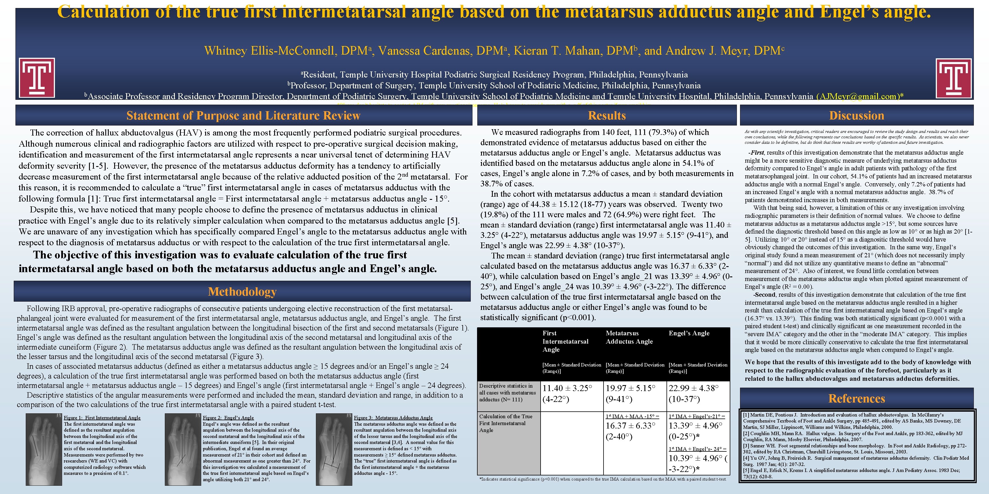 Calculation of the true first intermetatarsal angle based on the metatarsus adductus angle and
