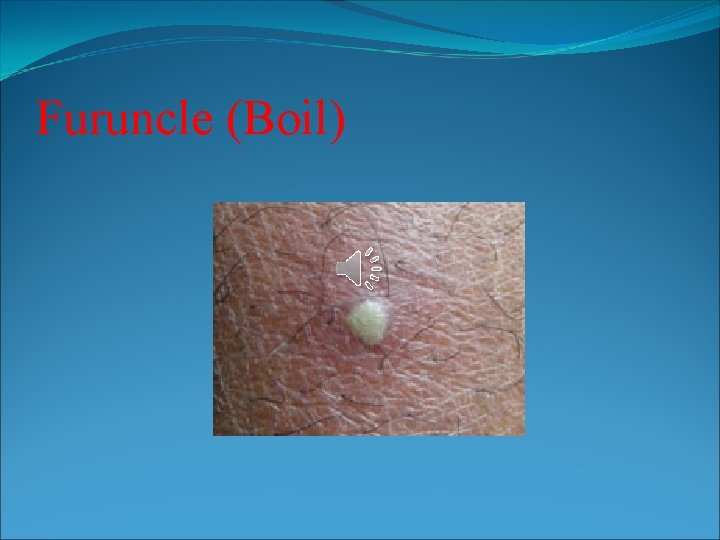 BACTERIAL SKIN DISEASES Prof Dr Eisha Abdel Moniem