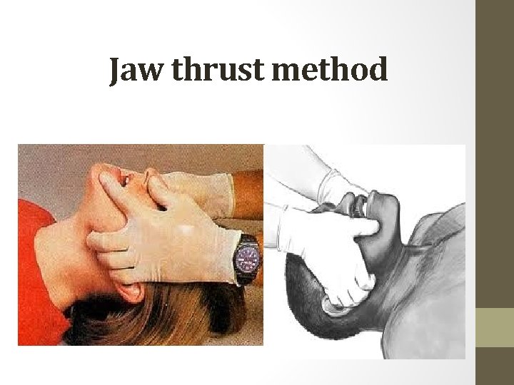 Jaw thrust method 