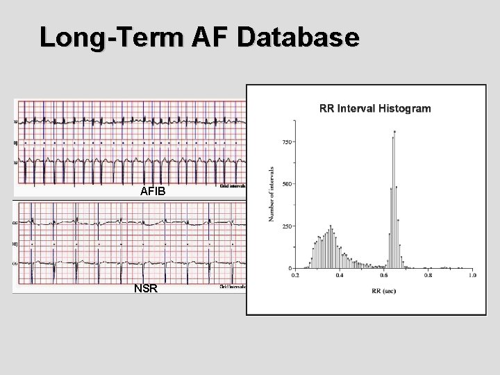 Long-Term AF Database AFIB NSR Long-Term AF Database AFIB NSR