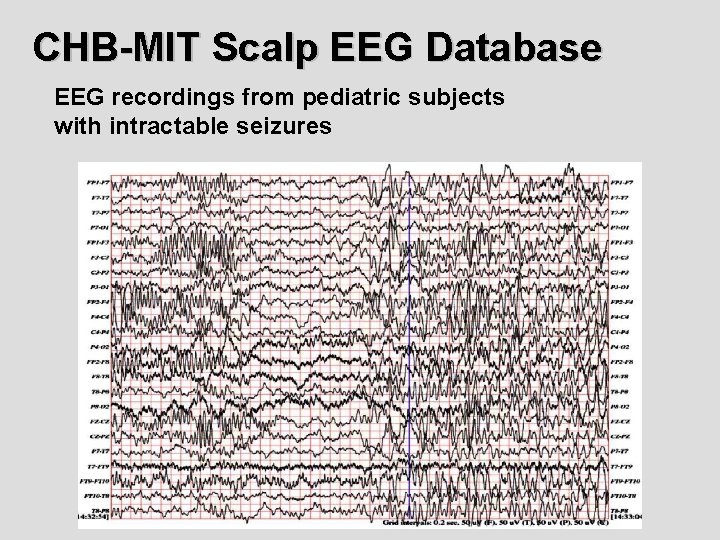CHB-MIT Scalp EEG Database EEG recordings from pediatric subjects with intractable seizures CHB-MIT Scalp EEG Database EEG recordings from pediatric subjects with intractable seizures