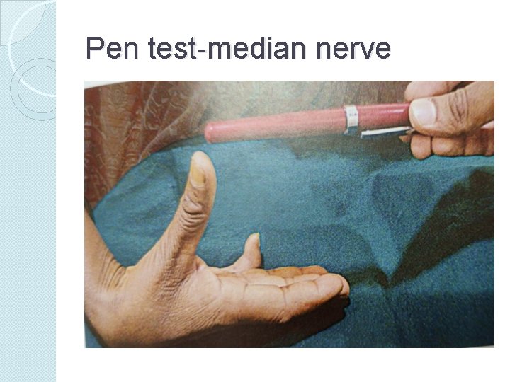 Pen test-median nerve 