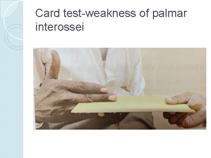 Card test-weakness of palmar interossei 