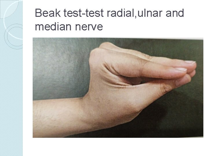 Beak test-test radial, ulnar and median nerve 