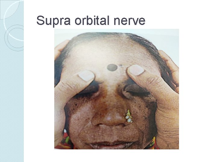Supra orbital nerve 