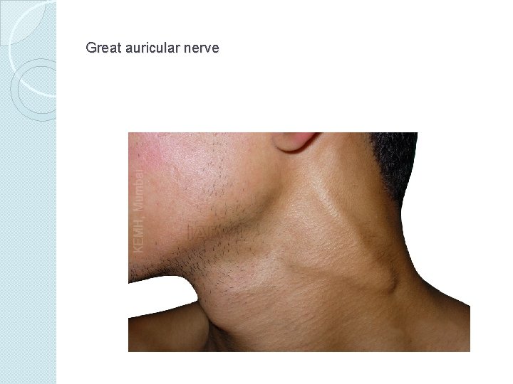 Great auricular nerve 