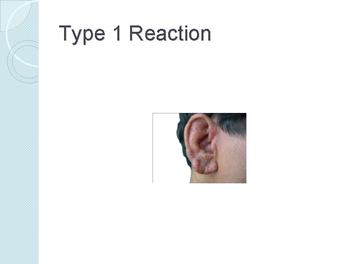 Type 1 Reaction 