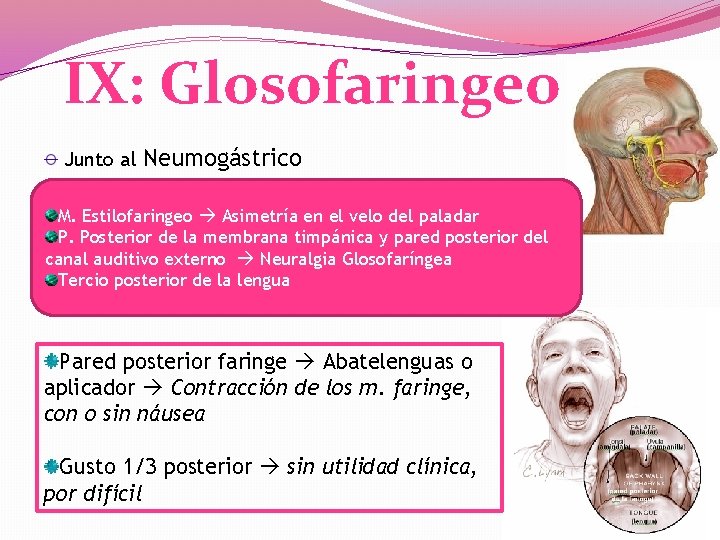 IX: Glosofaringeo Junto al Neumogástrico M. Estilofaringeo Asimetría en el velo del paladar P.