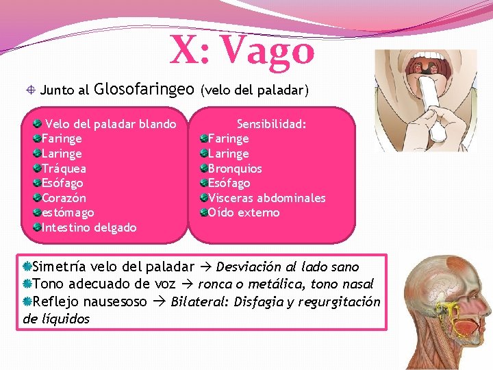 X: Vago Junto al Glosofaringeo (velo del paladar) Velo del paladar blando Faringe Laringe