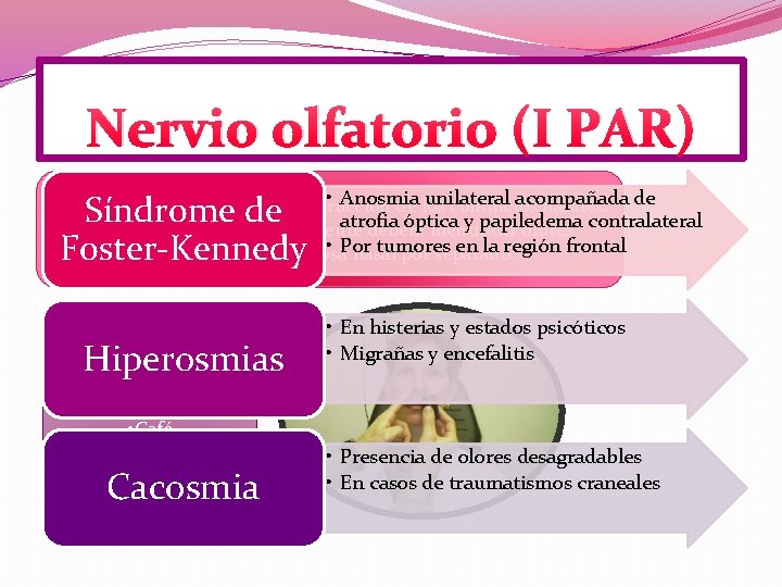 Nervio olfatorio (I PAR) • Anosmia unilateral acompañada Asegurarse de que no existe obstrucción