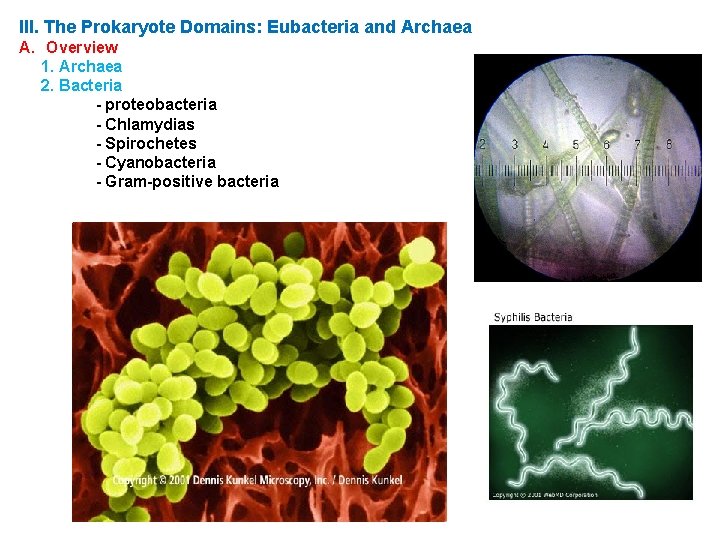 III. The Prokaryote Domains: Eubacteria and Archaea A. Overview 1. Archaea 2. Bacteria -