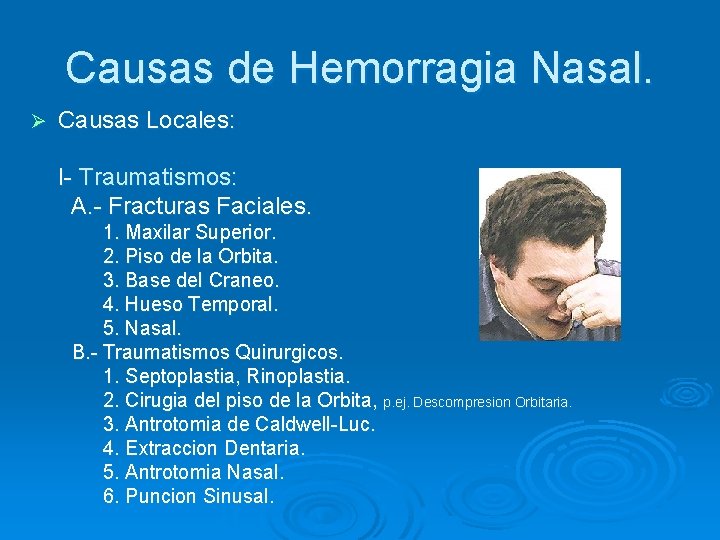 Causas de Hemorragia Nasal. Ø Causas Locales: I- Traumatismos: A. - Fracturas Faciales. 1.