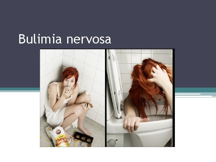 Bulimia nervosa 