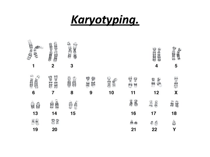 Karyotyping. 