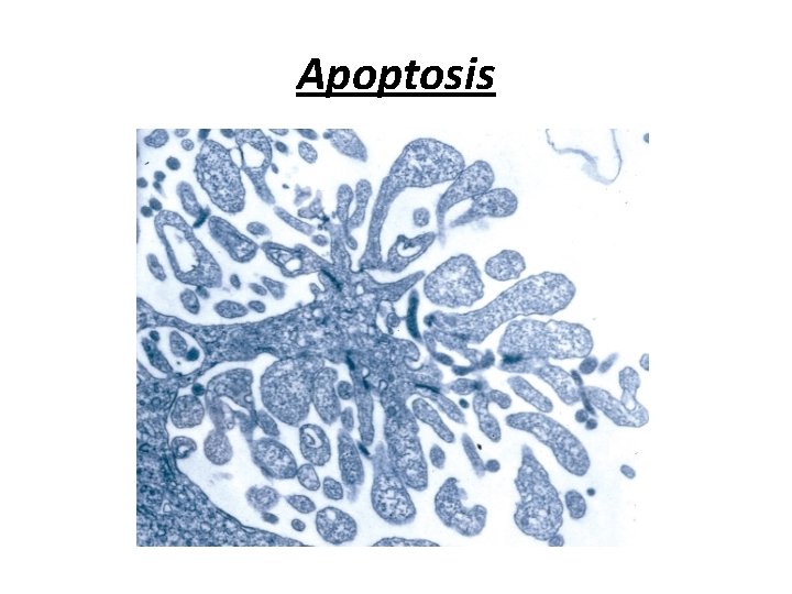 Apoptosis 