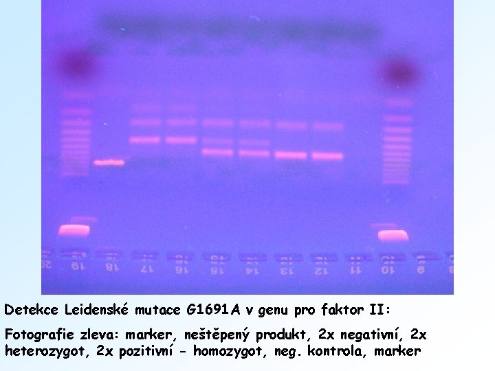 Detekce Leidenské mutace G 1691 A v genu pro faktor II: Fotografie zleva: marker,