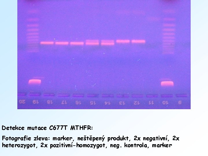 Detekce mutace C 677 T MTHFR: Fotografie zleva: marker, neštěpený produkt, 2 x negativní,