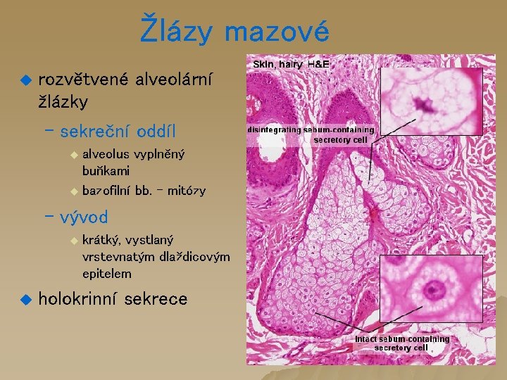 Žlázy mazové u rozvětvené alveolární žlázky – sekreční oddíl u alveolus vyplněný buňkami u