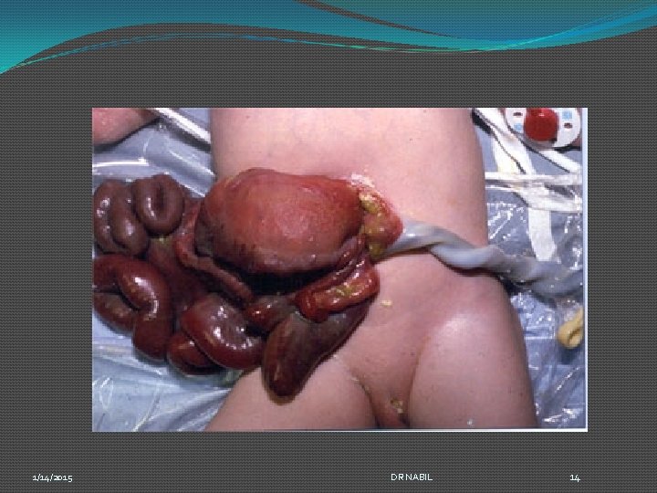 1/14/2015 DR NABIL 14 