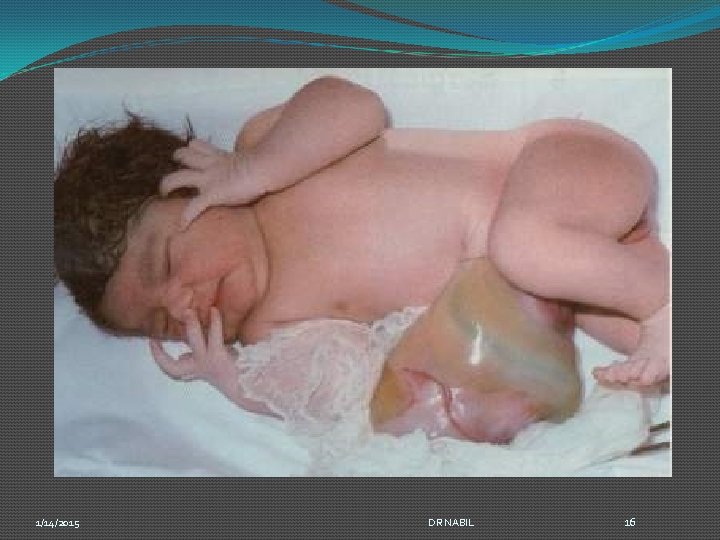 1/14/2015 DR NABIL 16 