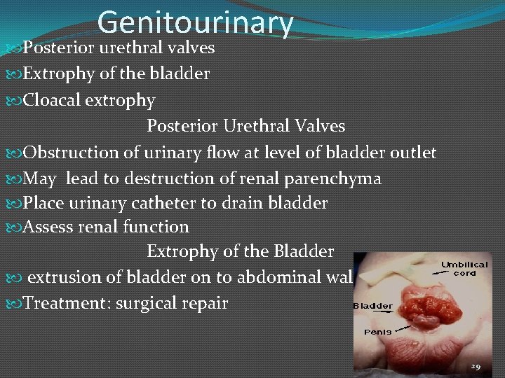 Genitourinary Posterior urethral valves Extrophy of the bladder Cloacal extrophy Posterior Urethral Valves Obstruction