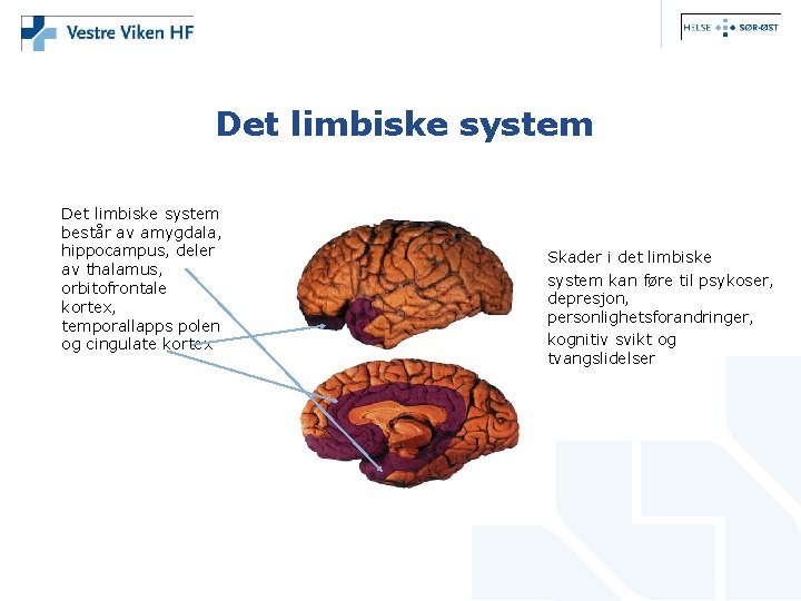 Det limbiske system består av amygdala, hippocampus, deler av thalamus, orbitofrontale kortex, temporallapps polen