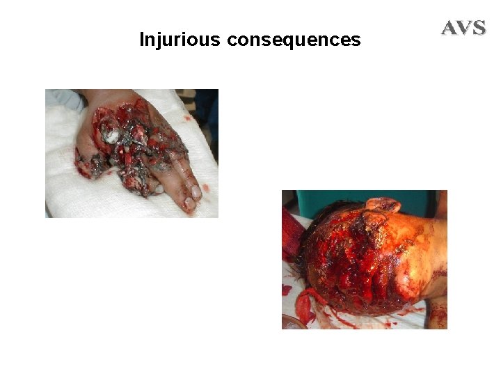 Injurious consequences 