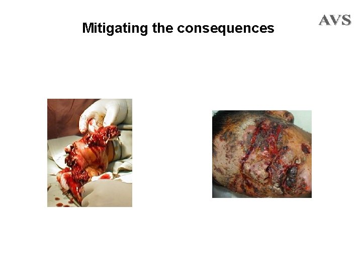 Mitigating the consequences 