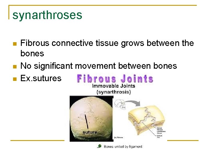 synarthroses n n n Fibrous connective tissue grows between the bones No significant movement