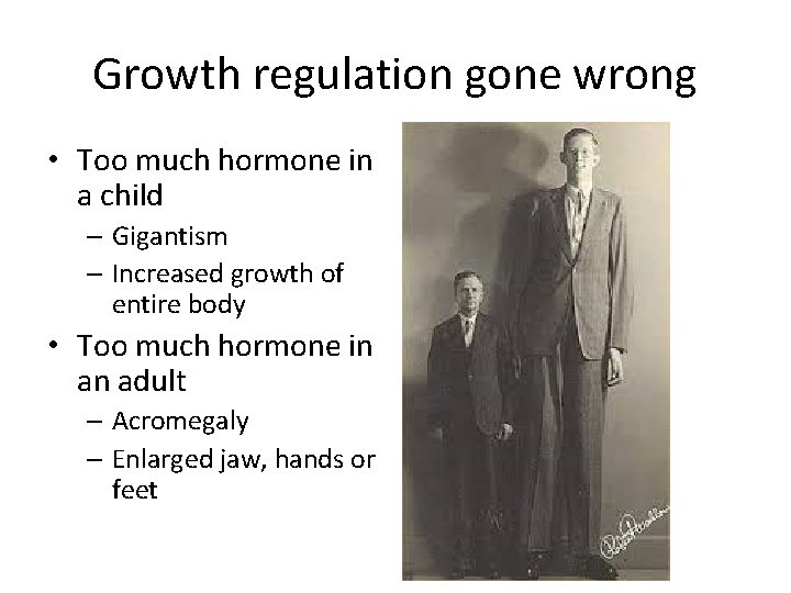 Growth regulation gone wrong • Too much hormone in a child – Gigantism –