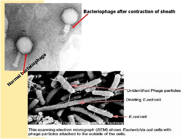Bacteriophage after contraction of sheath ge a h op r o N m al