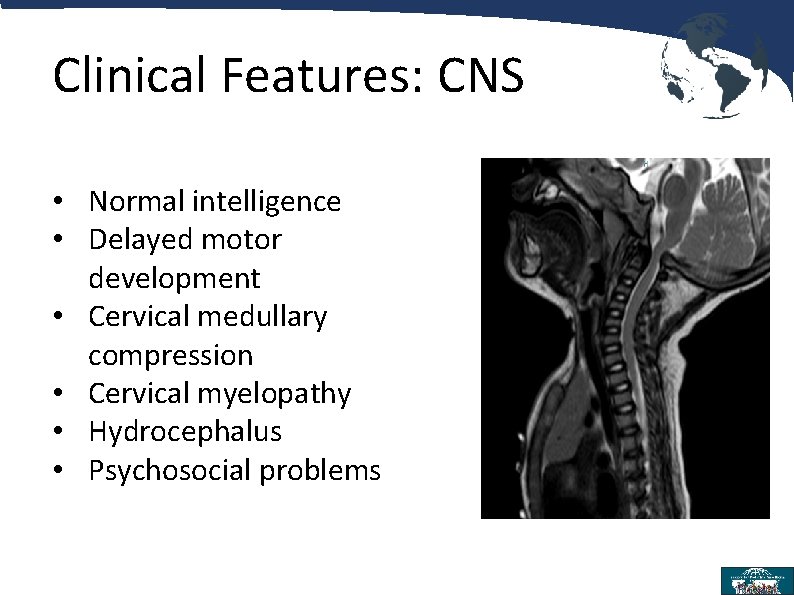 Clinical Features: CNS • Normal intelligence • Delayed motor development • Cervical medullary compression