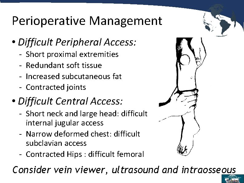 Perioperative Management • Difficult Peripheral Access: - Short proximal extremities Redundant soft tissue Increased