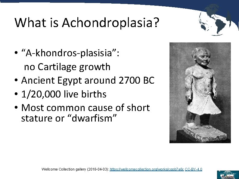 What is Achondroplasia? • “A-khondros-plasisia”: no Cartilage growth • Ancient Egypt around 2700 BC